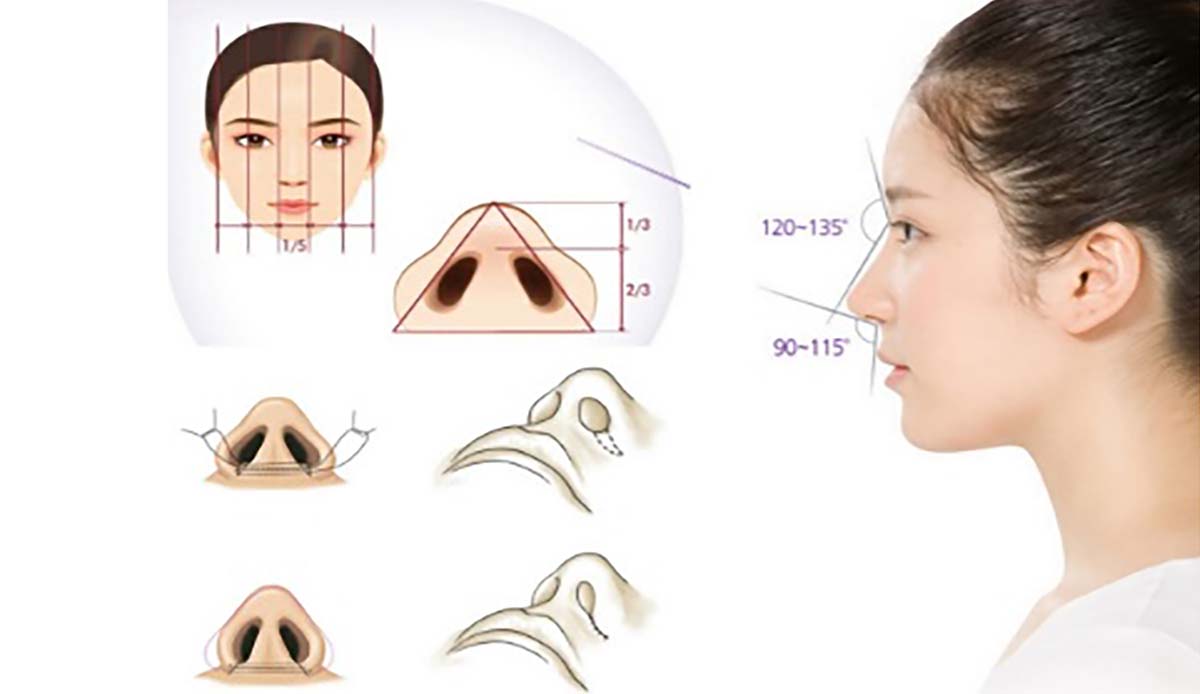 Cắt cánh mũi ảnh hưởng gì đến tướng số và phong thủy