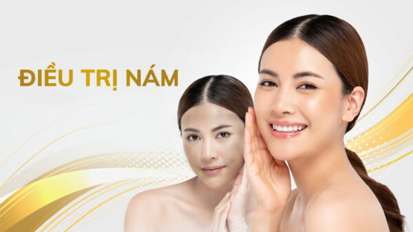 Điều trị nám da tại Thẩm mỹ Bs Tiến