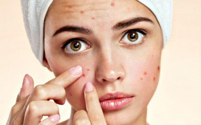 Cách Điều Trị Thâm Mụn